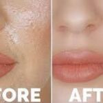 Skincare Products For Oily Skin