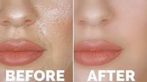 Skincare Products For Oily Skin